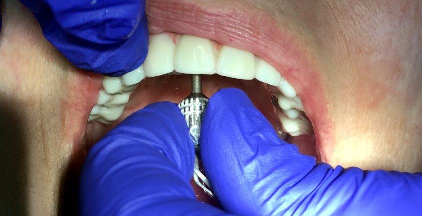 Procedimientos dentales